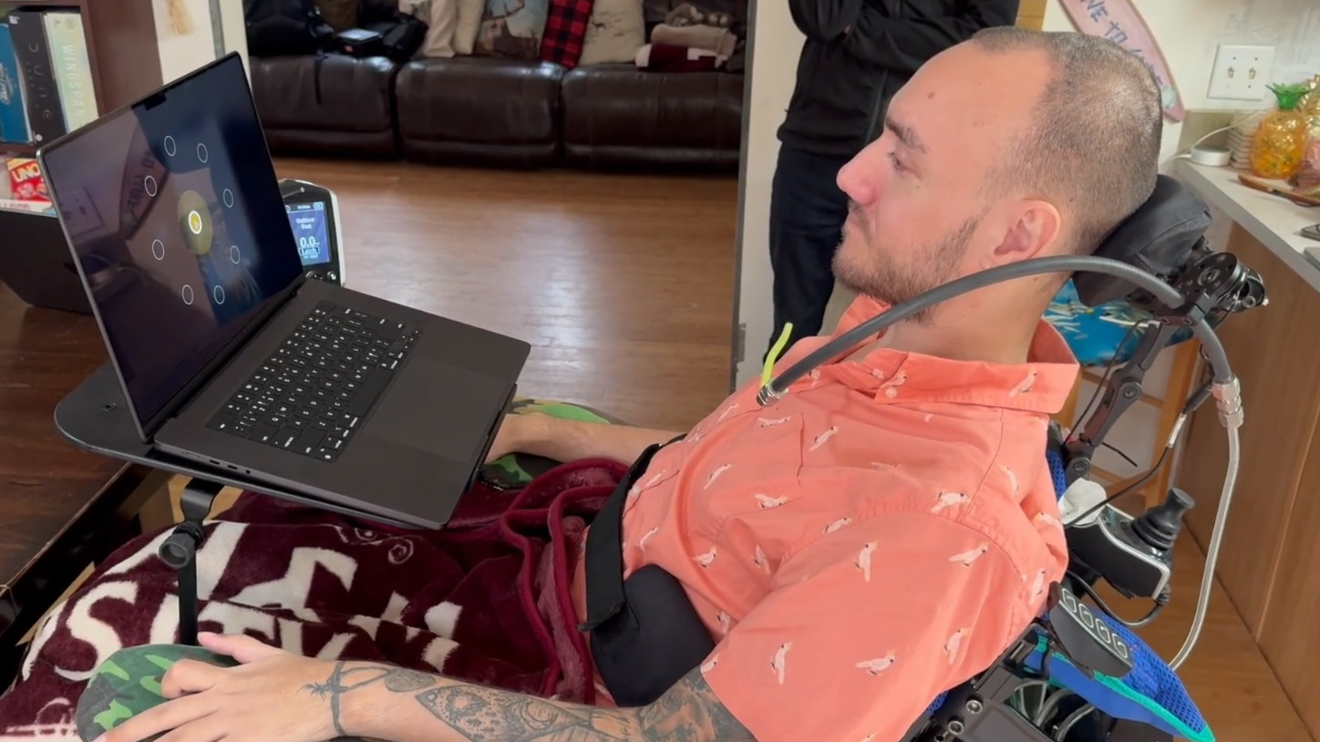 A Neuralink patient sits, watching a laptop connected to their thoughts.